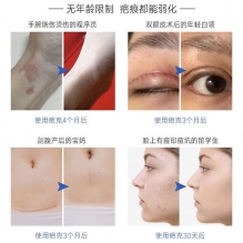 KeloCote疤克祛疤膏15g